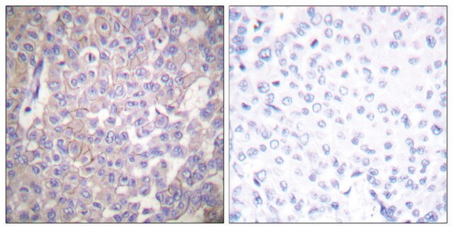 抗 Claudin 2 兔抗 affinity isolated antibody