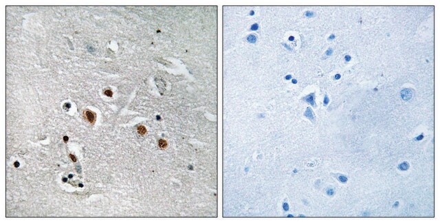 Anti-MED13L antibody produced in rabbit affinity isolated antibody