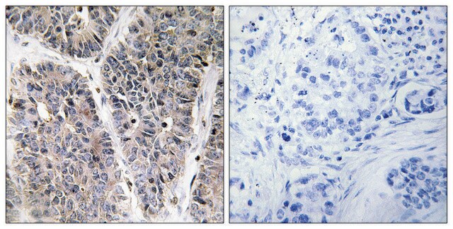 Anti-NBL1 antibody produced in rabbit affinity isolated antibody