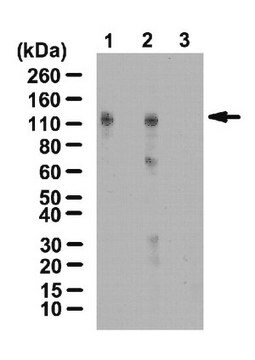 抗HIF-1-alpha抗体羟脯氨酸（Pro402） from rabbit, purified by affinity chromatography