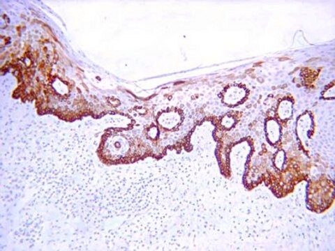 Anti-Cytokeratin 19 Antibody, clone RCK108 clone RCK108, Chemicon&#174;, from mouse