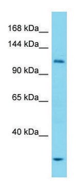 Anti-ULK1 (N-terminal) antibody produced in rabbit affinity isolated antibody