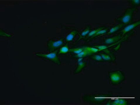 Anti-DCPS antibody produced in rabbit purified immunoglobulin, buffered aqueous solution