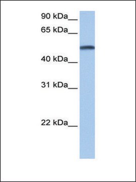 Anti-CYP1B1 affinity isolated antibody