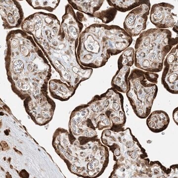 Anti-METTL21A antibody produced in rabbit Prestige Antibodies&#174; Powered by Atlas Antibodies, affinity isolated antibody, buffered aqueous glycerol solution