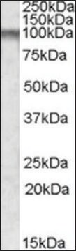 Anti-CPT1C antibody produced in goat affinity isolated antibody, buffered aqueous solution