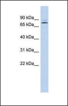 Anti-KLHL14, (N-terminal) antibody produced in rabbit affinity isolated antibody