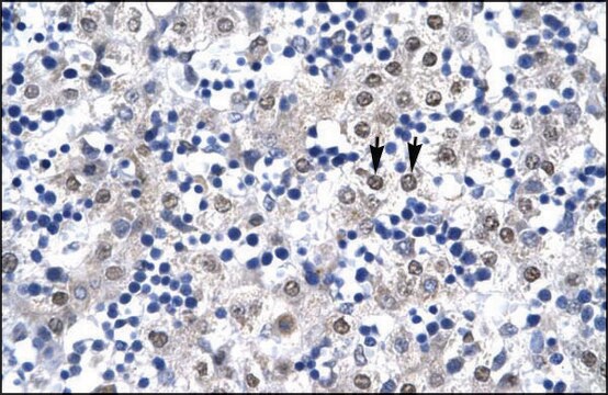 Anti-CDX4 (AB1) antibody produced in rabbit affinity isolated antibody