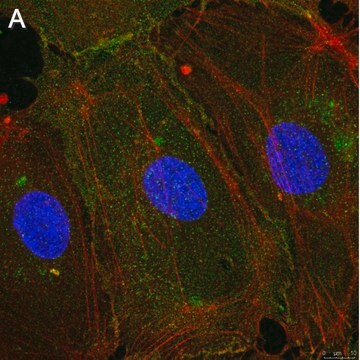 Anti-Integrin &#945;V&#946;3 Antibody, clone LM609 ZooMAb&#174; Mouse Monoclonal recombinant, expressed in HEK 293 cells