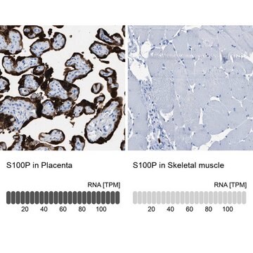 Anti-S100P antibody produced in rabbit Prestige Antibodies&#174; Powered by Atlas Antibodies, affinity isolated antibody, buffered aqueous glycerol solution