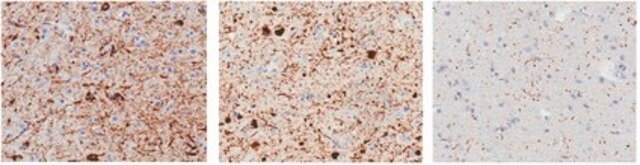 Anti-phospho-&#945;-Synuclein (Ser129) Antibody, clone 81A clone 81A, from mouse