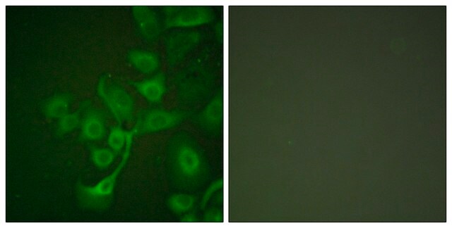 Anti-TIMP2 antibody produced in rabbit affinity isolated antibody