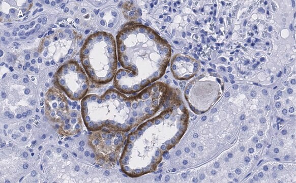 抗-KRas抗体，克隆2J13，ZooMAb&#174;兔单克隆抗体 recombinant, expressed in HEK 293 cells