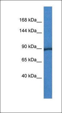 Anti-PYGM antibody produced in rabbit affinity isolated antibody