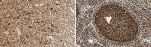 Anti-Neurofilament NF-H-Antikörper, phosphorylierter Antikörper, Klon&nbsp;NP1 clone NP1, from mouse