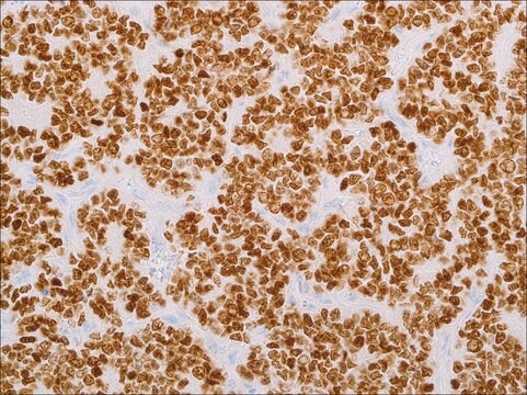 NKX2.2 (EP336) Rabbit Monoclonal Primary Antibody