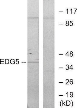 Anti-EDG5 antibody produced in rabbit affinity isolated antibody