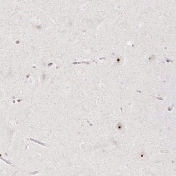 Anti-CHD2 antibody produced in rabbit Prestige Antibodies&#174; Powered by Atlas Antibodies, affinity isolated antibody, buffered aqueous glycerol solution