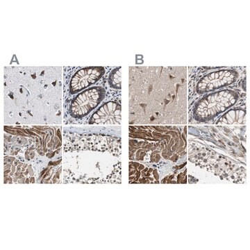 Anti-PITRM1 antibody produced in rabbit Ab2, Prestige Antibodies&#174; Powered by Atlas Antibodies, affinity isolated antibody, buffered aqueous glycerol solution