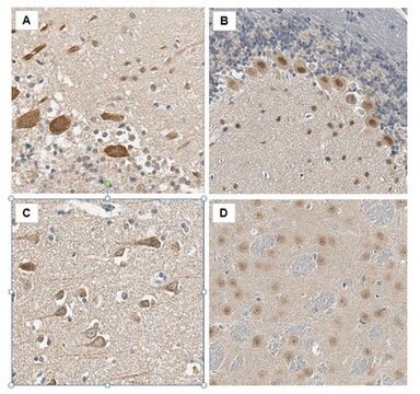 Anti-PRMT8 Antibody from rabbit, purified by affinity chromatography