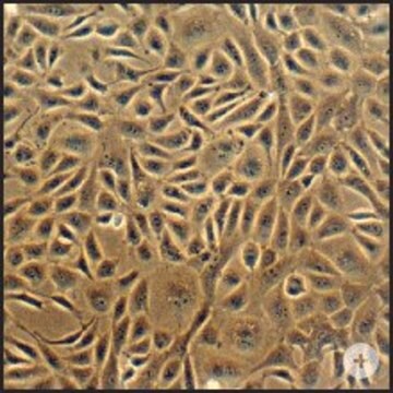 Bovine Coronary Artery Endothelial Cells: BCAEC (Cryovial)