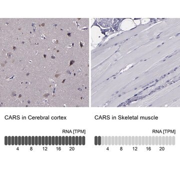 Anti-CARS antibody produced in rabbit Prestige Antibodies&#174; Powered by Atlas Antibodies, affinity isolated antibody, buffered aqueous glycerol solution