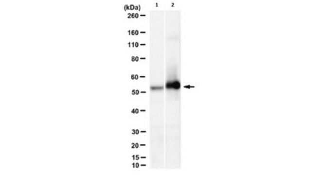 Anti-phospho-cytokeratin-8 (K8) (Ser431) Antibody, clone 5B3 clone 5B3, from mouse