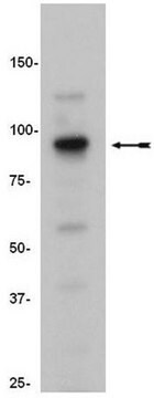 ChIPAb+ SUZ12 - ChIP Validated Antibody and Primer Set from mouse