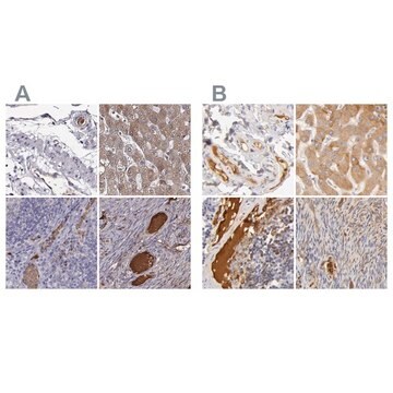 抗TF抗体 ウサギ宿主抗体 Ab2, Prestige Antibodies&#174; Powered by Atlas Antibodies, affinity isolated antibody, buffered aqueous glycerol solution