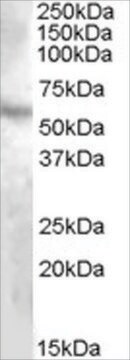 抗DMP1抗体 ヤギ宿主抗体 affinity isolated antibody, buffered aqueous solution