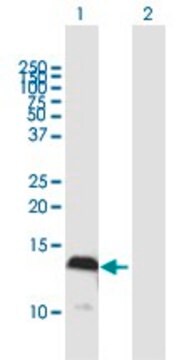 Anti-S100A4 antibody produced in mouse purified immunoglobulin, buffered aqueous solution