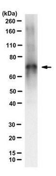 Przeciwciało anty-Tau, klon 2A1-2E1 clone 2A1-2E1, from mouse