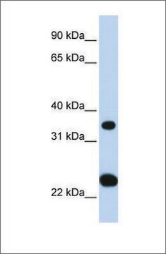 抗SLC25A35抗体 ウサギ宿主抗体 affinity isolated antibody