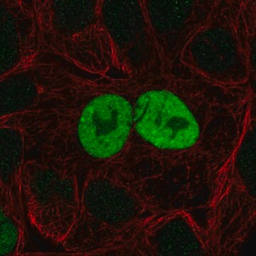 Anty-CDKN1A Prestige Antibodies&#174; Powered by Atlas Antibodies, affinity isolated antibody