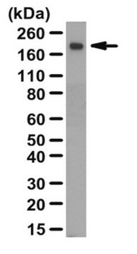 Przeciwciało przeciw trombospondynie-2 from rabbit, purified by affinity chromatography