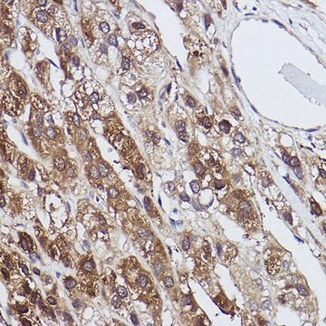 Anti-FBP1 antibody produced in rabbit