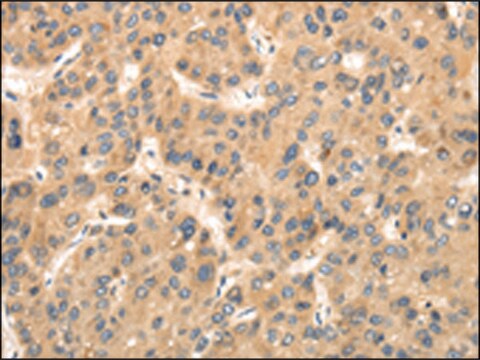 Anti-TTC23 affinity isolated antibody