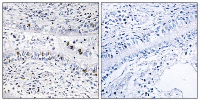 Anti-EZH1 antibody produced in rabbit affinity isolated antibody