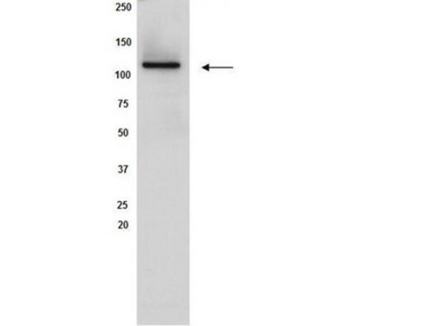 Anti-Sirt1 Antibody, clone 3H10.2 clone 3H10.2, Upstate&#174;, from mouse