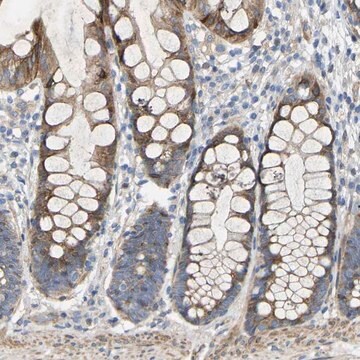 Anti-TOR1B antibody produced in rabbit Prestige Antibodies&#174; Powered by Atlas Antibodies, affinity isolated antibody, buffered aqueous glycerol solution, Ab1