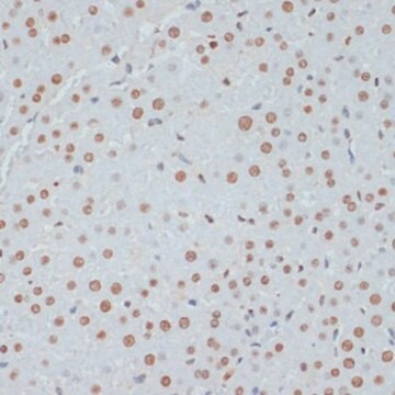 Anti-Phospho-TP53-S33 antibody produced in rabbit