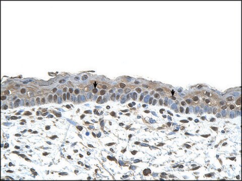 Anti-CENPA antibody produced in rabbit IgG fraction of antiserum