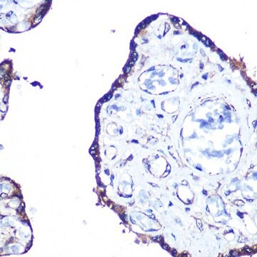 Anti-MAP1LC3A antibody produced in rabbit