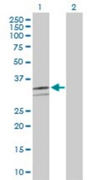 Anti-CD46, (N-terminal) antibody produced in rabbit purified immunoglobulin, buffered aqueous solution