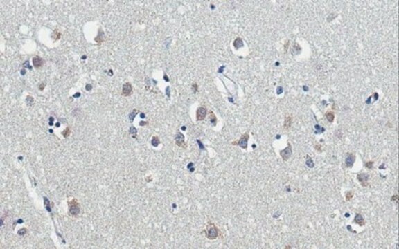 Anti-Kallikrein 6/KLK6 Antibody, clone E24 clone E24, from mouse