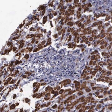 Anti-MAP3K9 antibody produced in rabbit Prestige Antibodies&#174; Powered by Atlas Antibodies, affinity isolated antibody, buffered aqueous glycerol solution