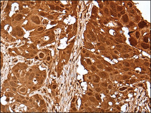 抗UBE2V1抗体 affinity isolated antibody