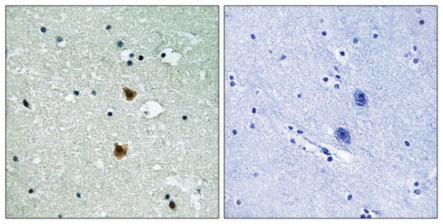 Anti-HSP27 antibody produced in rabbit affinity isolated antibody