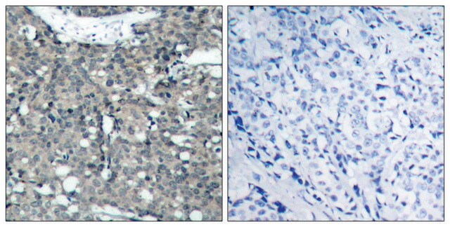 Anti-Paxillin antibody produced in rabbit affinity isolated antibody