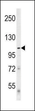 ANTI-DENATURED ATG1 antibody produced in rabbit purified immunoglobulin, buffered aqueous solution